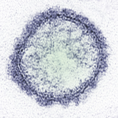Virus_de_Schmallenger.jpg